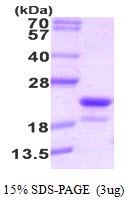 Human Riboflavin Kinase (RFK)