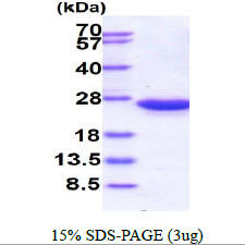 Human RAC2