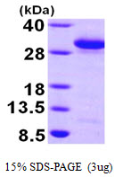 Human RAB27A