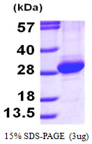 Human RAB11A