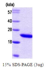 Human Retinol-Binding Protein 4 (RBP4)