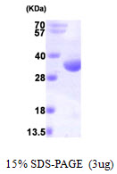 Human RQCD1
