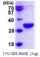 Human RPP30