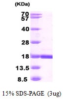 Human Retinoid-Binding Protein 7 (RBP7)