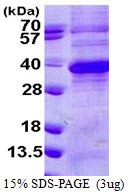 Human Regucalcin (RGN)