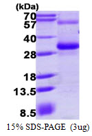 Human RGS17