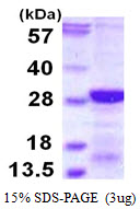 Human RCAN2