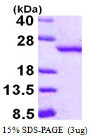 Human RBBP9