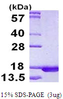 Human RPLP2