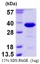 Human RANBP1