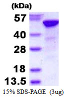 Human Retinoblastoma-Binding Protein 4 (RBBP-4)