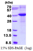 Human Renalase
