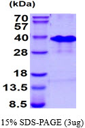 Human RNF4