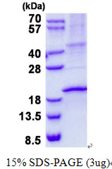 Human Ribonuclease 3 (RNASE3)