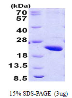 Human RNA Polymerases I, II, III Subunit ABC3  (RPB17)