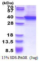 Human Retinaldehyde-Binding Protein 1 (RLBP1)