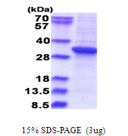 Human RSU1