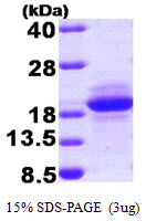 Human SDNSF