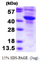 Human Sulfotransferase 2B1