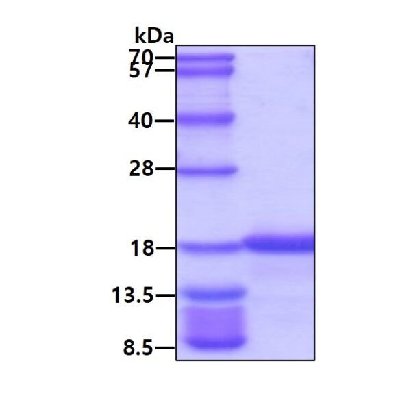 Human alpha-Synuclein