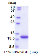 Human SYNJ2BP