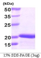 Human Stathmin-1