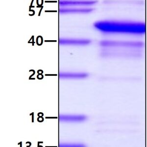 Human SQSTM1