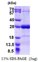 Human Synaptosomal-associated Protein 25 (SNAP-25)