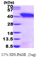 Human SNURPORTIN1