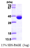Human Spermidine Synthase (SPDSY)