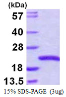 Human SNX3