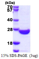 Human SENP8