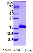 Human SAT2