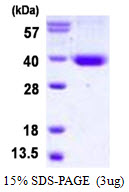 Human STX11