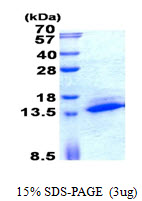 Human SAMD13