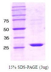 Human Protein-Tyrosine Phosphatase, Non-Receptor Type 6 Isoform 1 (SHP-1)