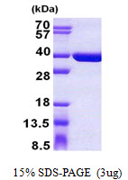 Human Sulfotransferase 1C4 (SULT1C4)