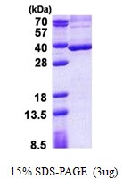 Human Stanniocalcin-2 (STC-2)
