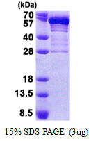Human Secretogranin-3 (SCG3)