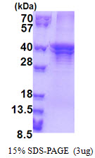 Human ST3GAL5