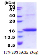 Human Metalloreductase STEAP4