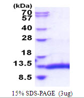 Human SEPW1