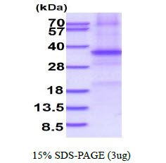 Human SFRP5