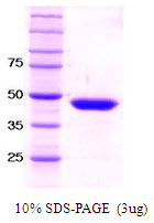 Human SET Domain-containing Protein 7 (SET7/9)