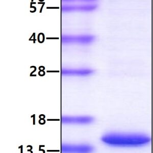 Human Serum Amyloid A (SAA)