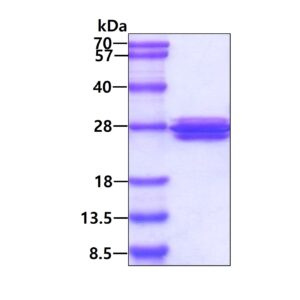Human Transgelin