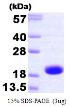 Human TNNC2