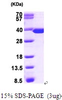 Human Thymidylate Synthase (TS)
