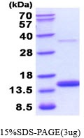 Human Thioredoxin-1 (TRX1)