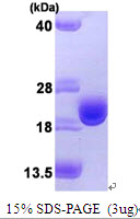 Human Thioredoxin